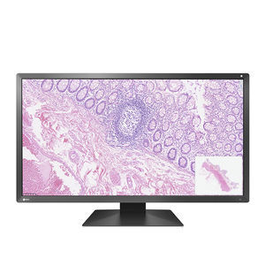 液晶显示器