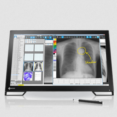 液晶显示器 - MS236WT series - EIZO NANAO - PCAP电容式触摸屏 / 多点触摸屏式 / LED背光