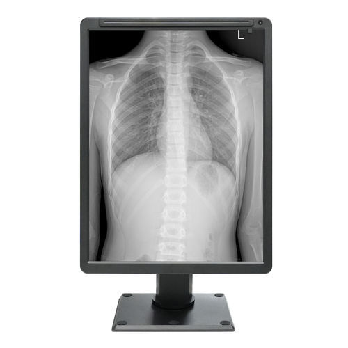医用显示板 - MDC-G2201 - ZRT Technology - 单色 / 21.3" / HDMI