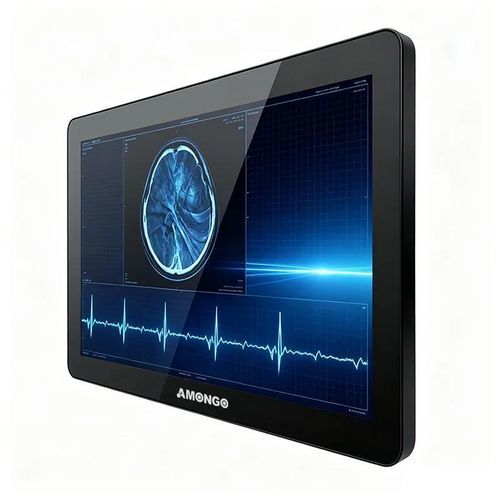 带触摸屏显示器 - AMG-15OPTD01G1 - AMONGO Display Technology(ShenZhen)Co.,LTD - LED背光 / 医用 / 15.6"